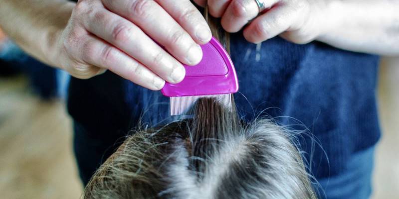 Cara Mengatasi Kutu Rambut